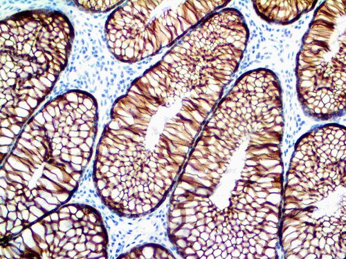IHC of Cytokeratin 18 on an FFPE Colon Tissue